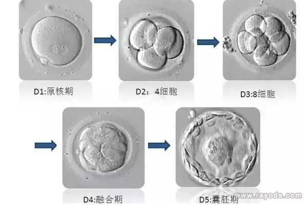 胚胎移植可以选择男女,移植时是如何选择胚胎的？胚胎质量等级怎么区分