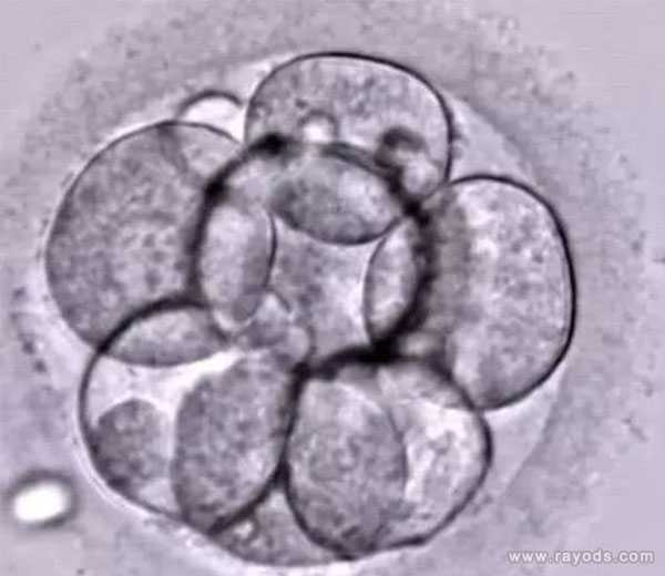 胚胎移植可以选择男女,移植时是如何选择胚胎的？胚胎质量等级怎么区分