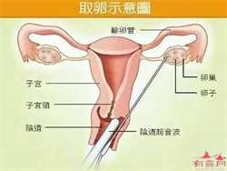 江苏省中医院能做供卵试管婴儿吗？成功率能高吗？